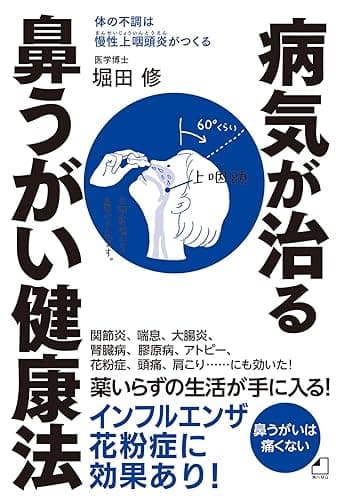 よくわかる最新療法　病気が治る鼻うがい健康法　体の不調は慢性上咽頭炎がつくる (角川マガジンズ)
