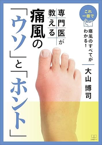 これ一冊で痛風のすべてがわかる!専門医が教える痛風の「ウソ」と「ホント」(22世紀アート)